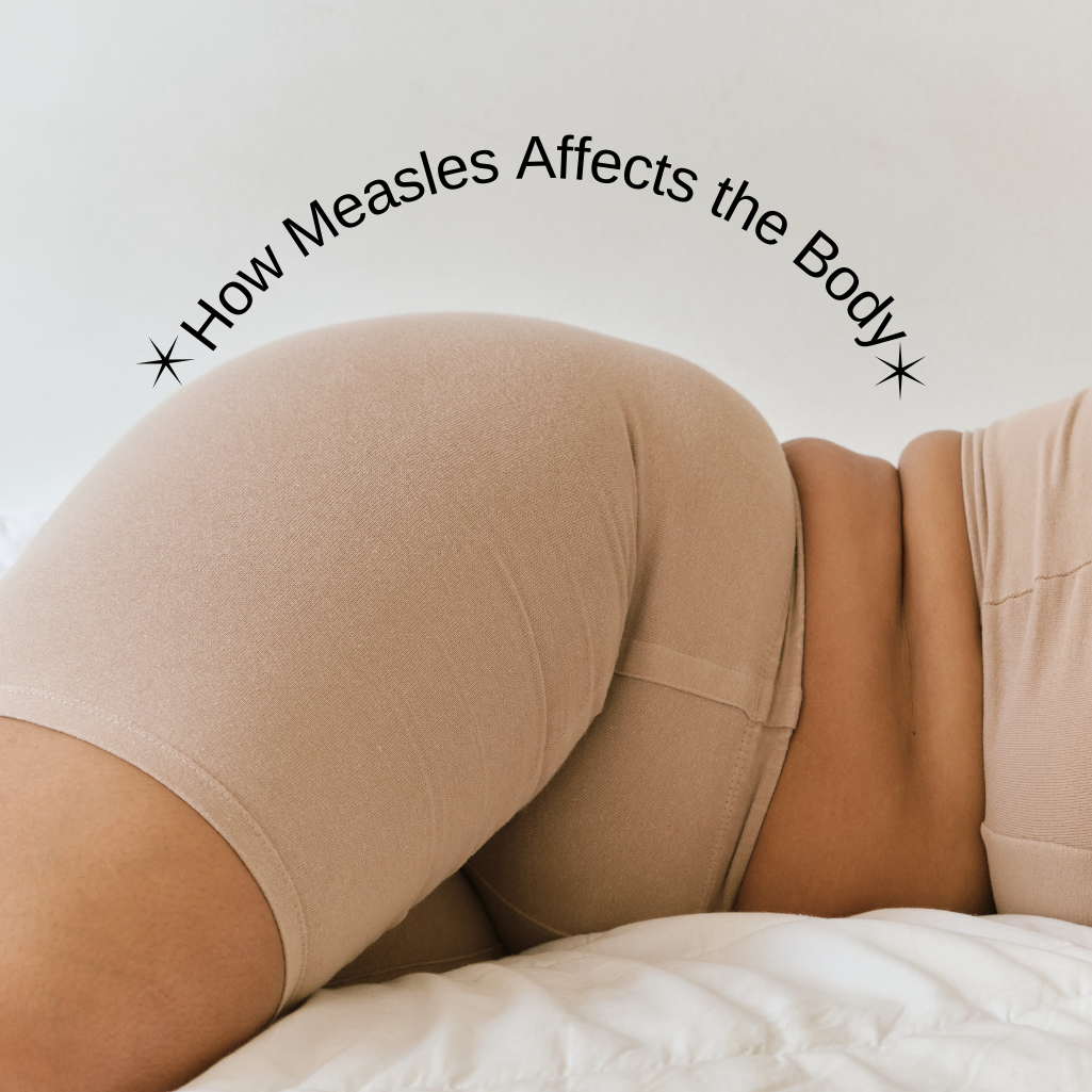 How Measles Affects the Body