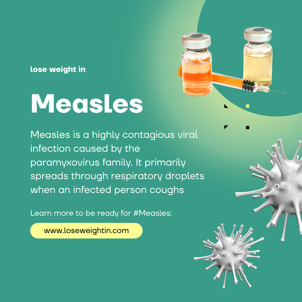 Measles