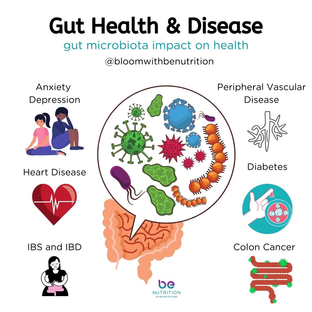 Balancing Your Gut Health: practical Tips for Implementation