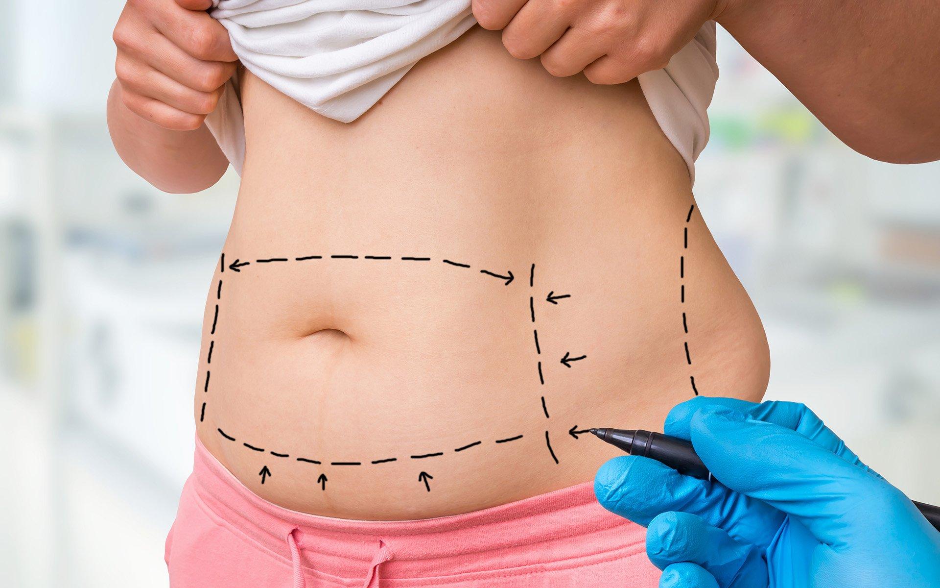 Targeted Fat Loss: Engaging ​Core and Full-Body Routines