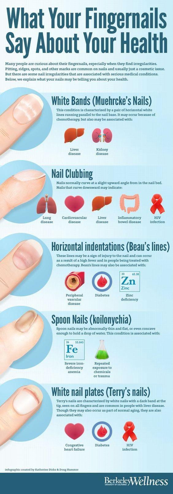 Nail ⁤Health and ⁣Detox Strengthen from the Inside Out